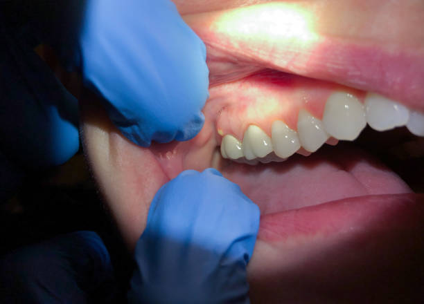 Best Broken Tooth Emergency  in Oak Grove, MO